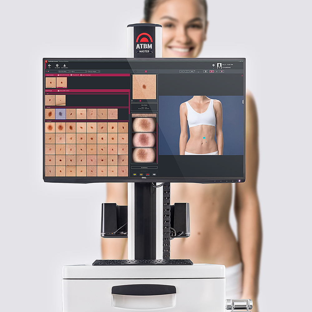 ATBM MASTER Wideodermatoskopia lublin badanie wideodermatoskopem