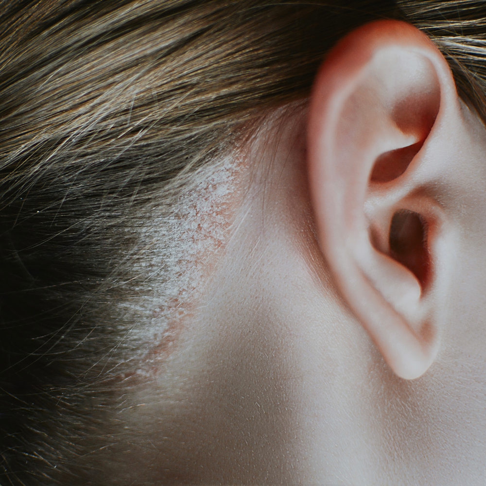 trycholog lublin leczenia zmian skóry głowy