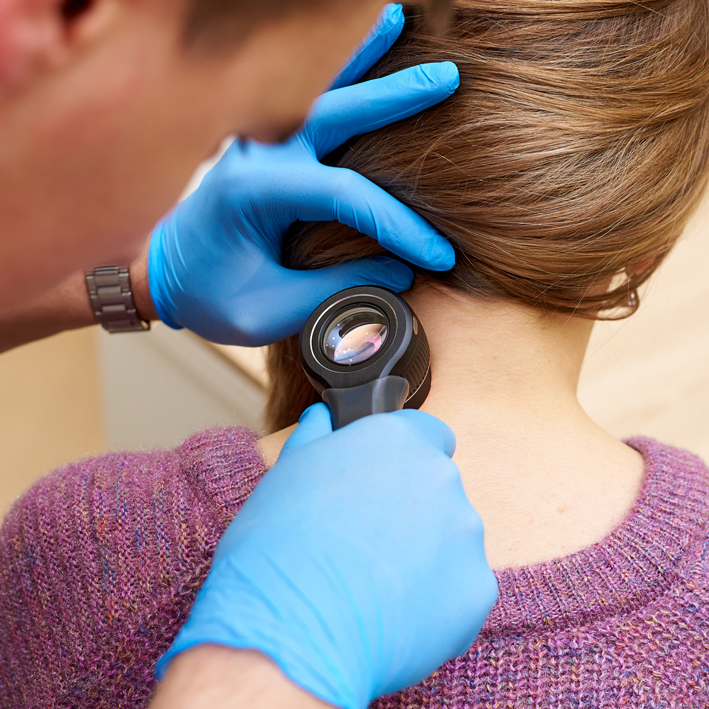 badanie dermatoskopowe