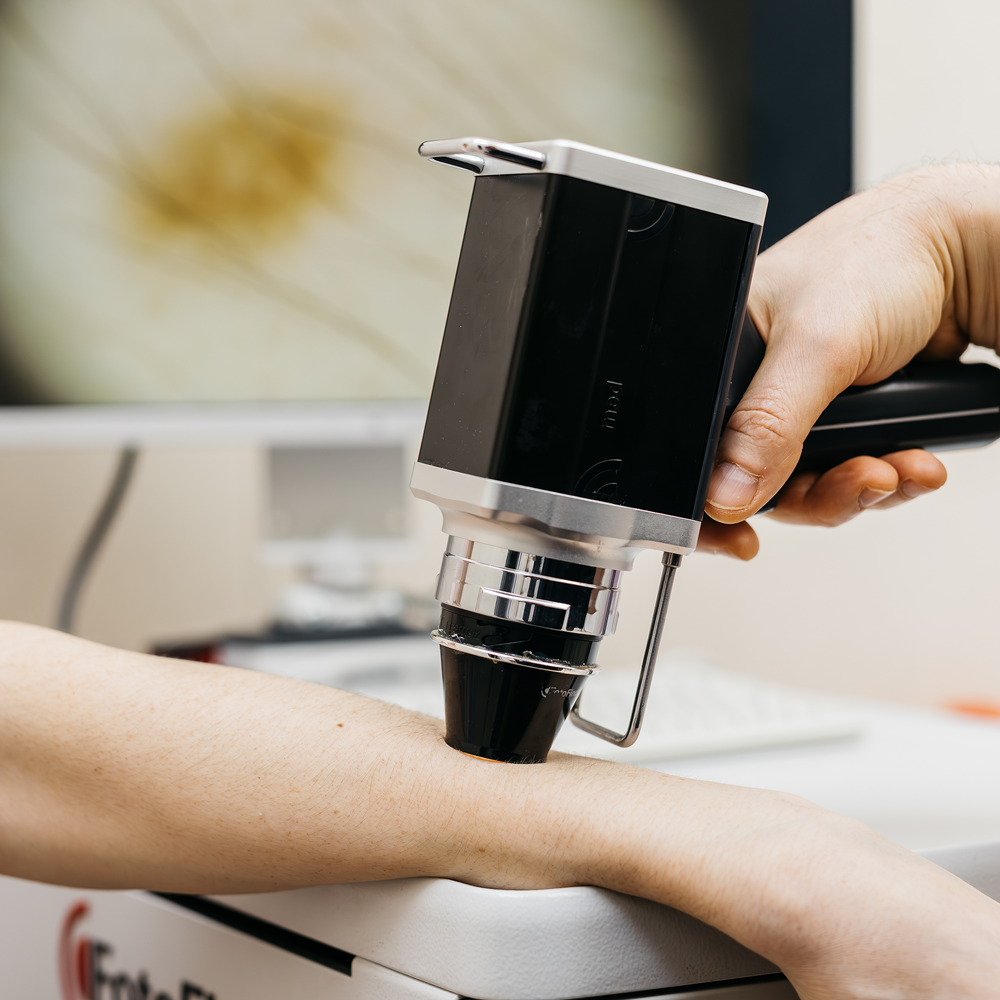 Wideodermatoskopia w Lublinie