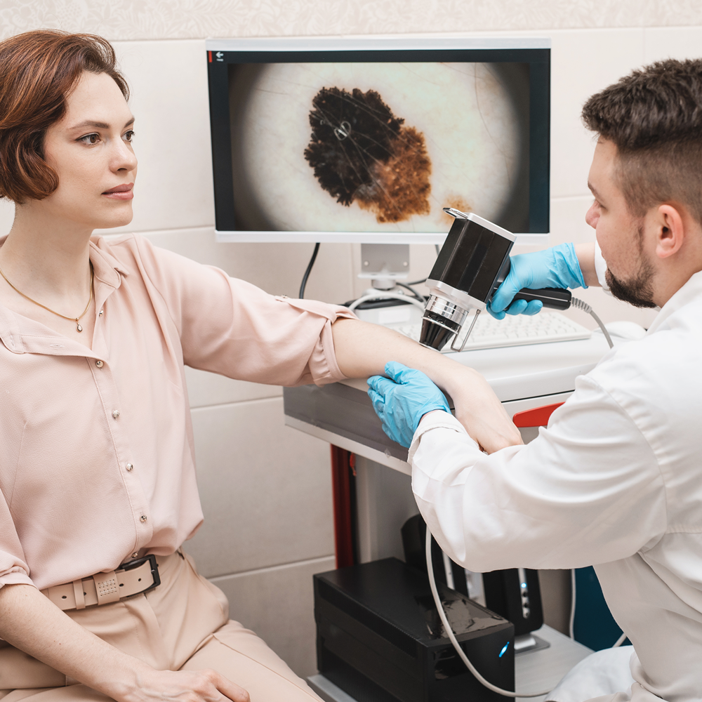 Badanie wideodermatoskopem